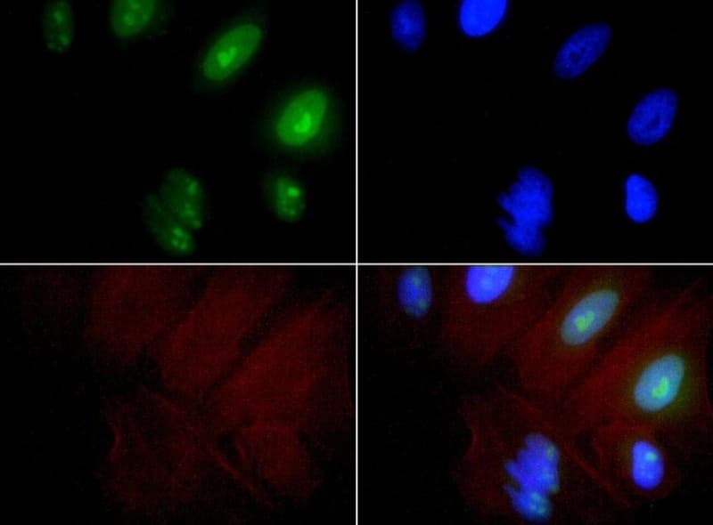 EXOSC9 / p5 Antibody