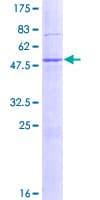 Human ERdj4 / DNAJB9 Protein (Recombinant GST)