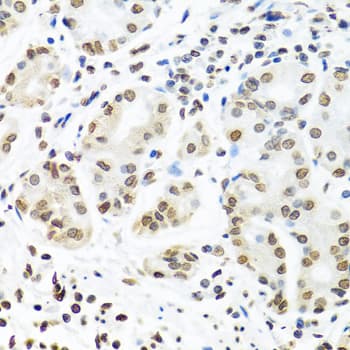 Polyclonal Rabbit anti-Human CRD-BP / ZBP1 / IGF2BP1 Antibody (IHC, IF, WB)