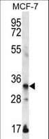 EVPLL Antibody (aa118-146)