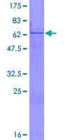 Human B3GNT3 / TMEM3 Protein (Recombinant GST)