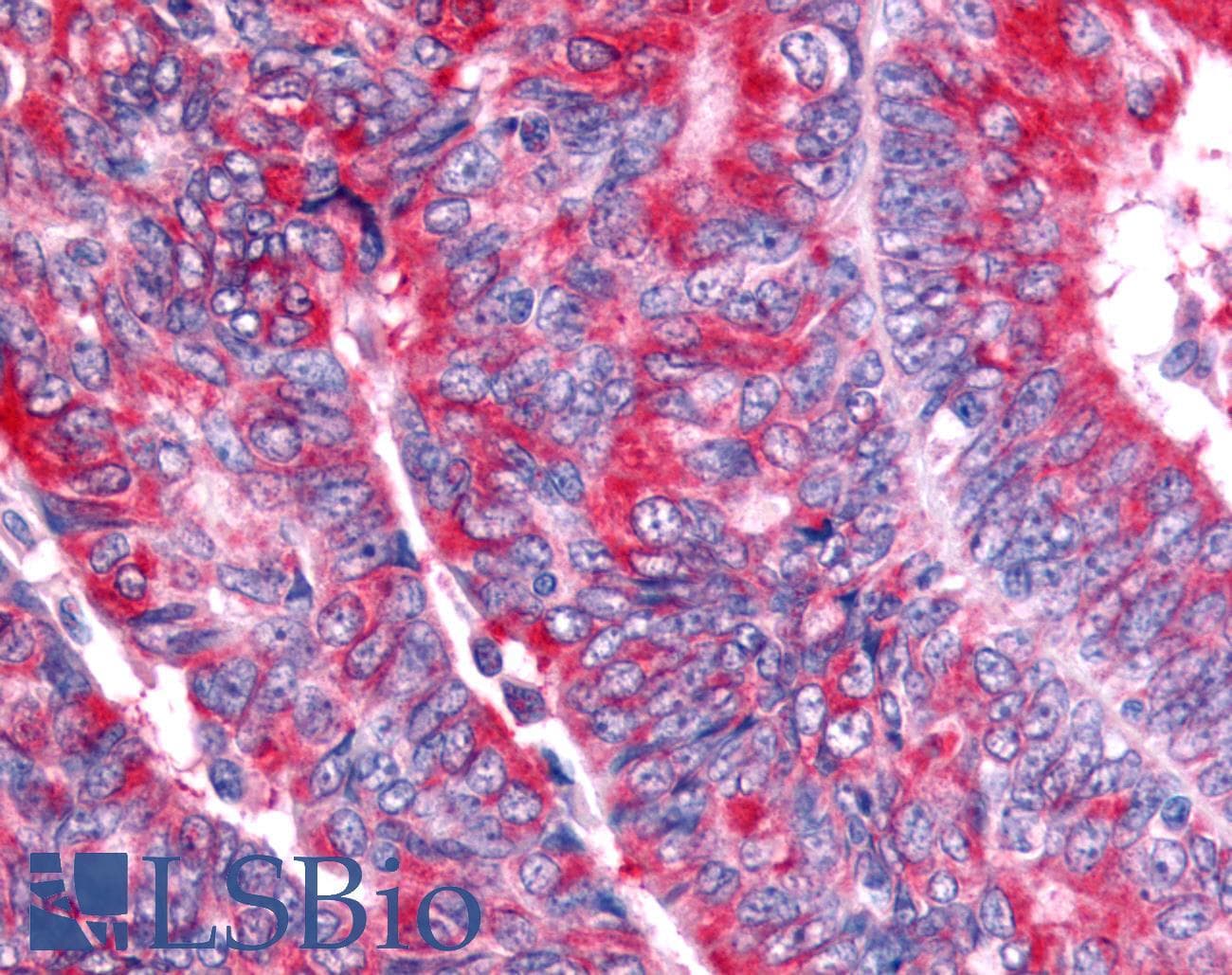 PathPlus™ Nor-1 / NR4A3 Antibody (Modulating Domain)