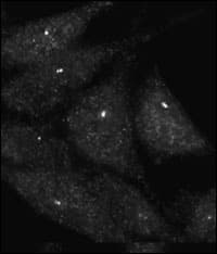 UVRAG Antibody (aa666-699)