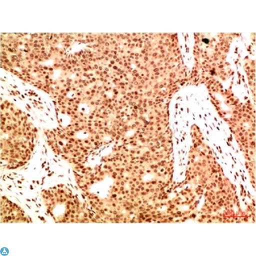 RELA / NFKB p65 Antibody
