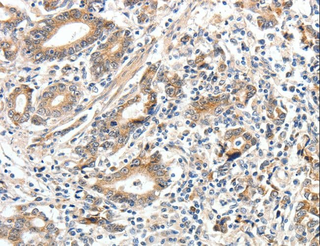 ECE2 Antibody