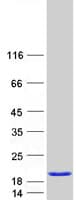 Human SCOC Protein (Recombinant Myc-DDK (Flag))