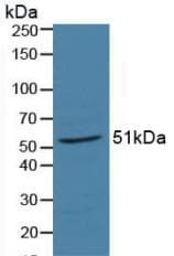 RARA / RAR Alpha Antibody (aa68-173)