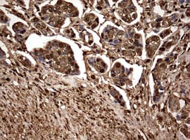 Monoclonal Mouse anti-Human GAPDH Antibody (clone OTI2F9, IHC, WB)