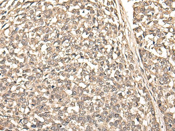 Polyclonal Rabbit anti-Human BUD31 Antibody (IHC, WB)