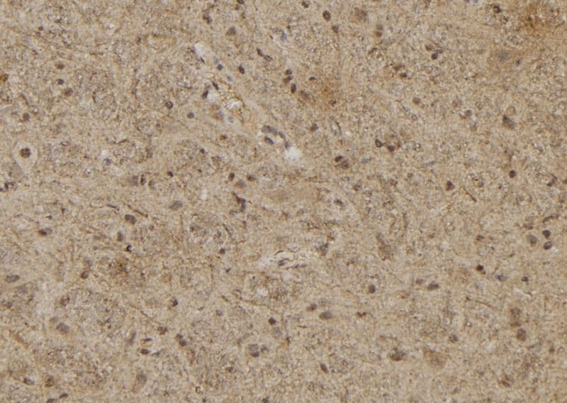 Polyclonal Rabbit anti-Human RASSF8 Antibody (IHC, WB)