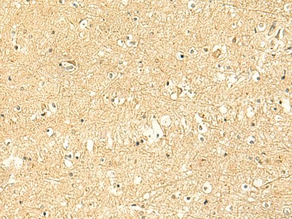 POLR3F Antibody