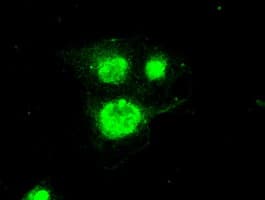 POSTN / Periostin Antibody (clone OTI1A1)