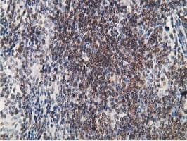 PDLIM2 / SLIM Antibody (clone OTI11A12)