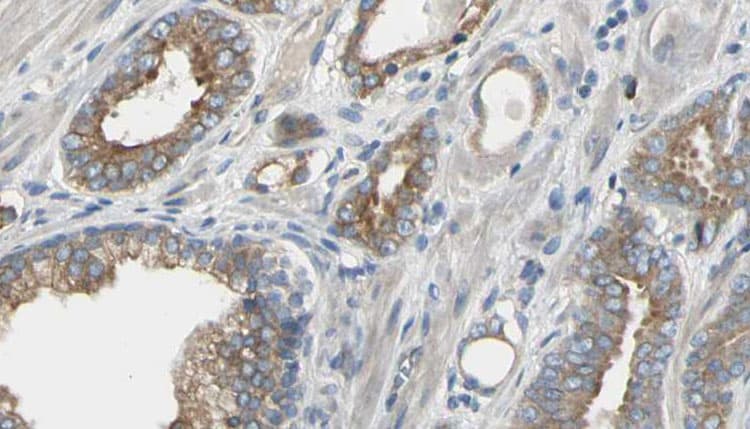 HDC / Histidine Decarboxylase Antibody