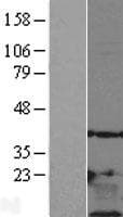 TMSB10 / Thymosin Beta 10 Protein (Over-Expression Lysate Myc-DDK (Flag))