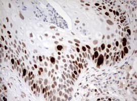 TOP2A / Topoisomerase II Alpha Antibody (aa1100-1531, clone OTI2A9)