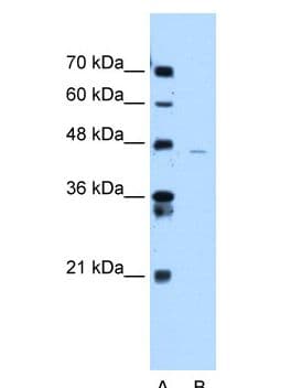 Polyclonal Rabbit anti-Human ANKRD65 Antibody (aa341-390, WB)