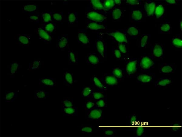 Monoclonal Mouse anti-Human TRIM33 / TIF1-Gamma Antibody (clone 6D1, IHC, IF, WB)