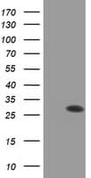 PSMB9 Antibody (clone OTI1G7)