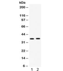 FOSB Antibody