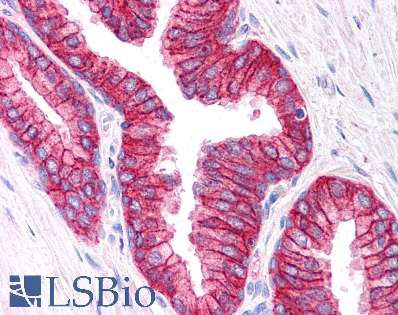 IHC-plus™ ABCC4 / MRP4 Antibody (aa1312-1325)