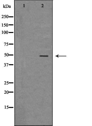 Polyclonal Rabbit anti-Human IDH1 / IDH Antibody (IHC, WB)