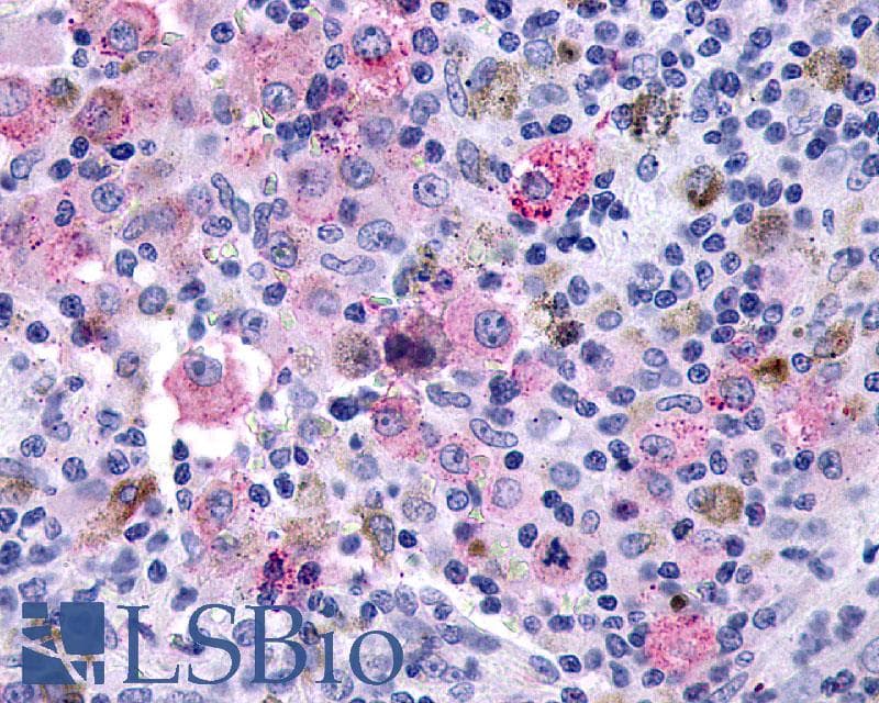 PathPlus™ GLP2R Antibody (C-Terminus)