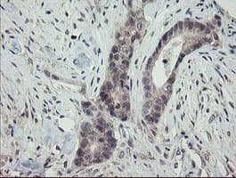 ARL2BP / BART Antibody (clone OTI1A10)
