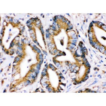 HSPA9 / Mortalin / GRP75 Antibody (aa646-679)