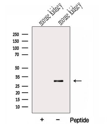 GNPDA2 Antibody