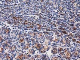 TUBB4 / Tubulin Beta 4 Antibody (clone 3C12, Carrier-free)