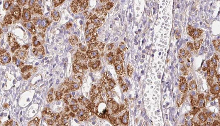 PLCH2 Antibody