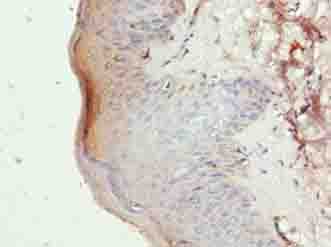 Polyclonal Rabbit anti-Human SLC46A3 Antibody (IHC, WB)