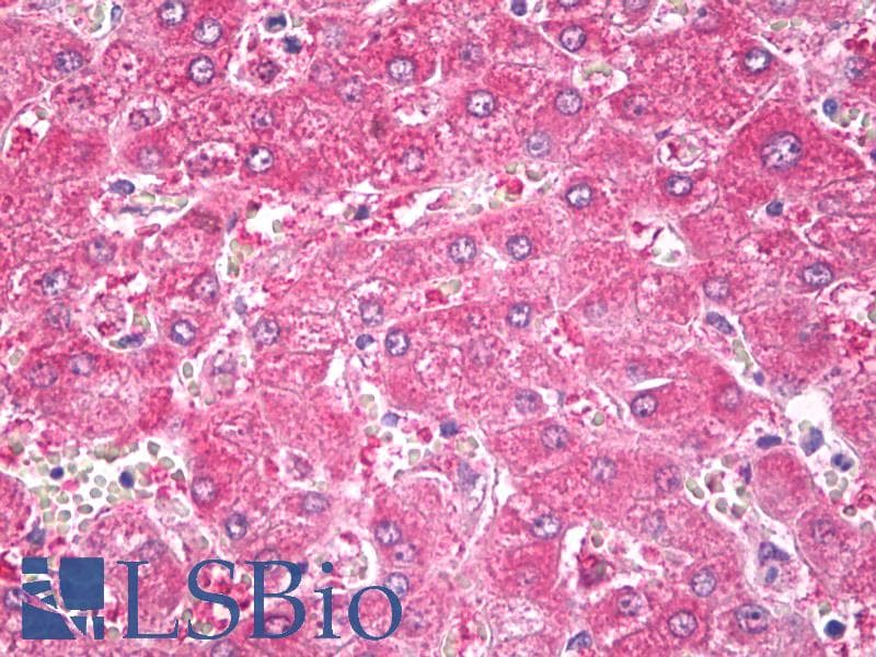 IHC-plus™ ALDH2 Antibody (Internal, clone EPR4493)