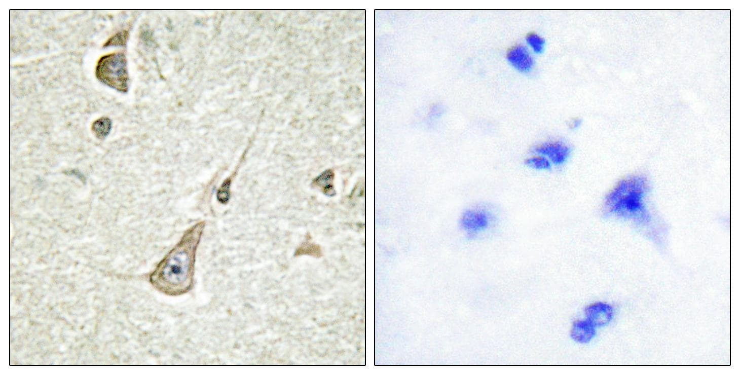 Polyclonal Rabbit anti-Human PCDH11Y / Protocadherin Y Antibody (IHC, IF)
