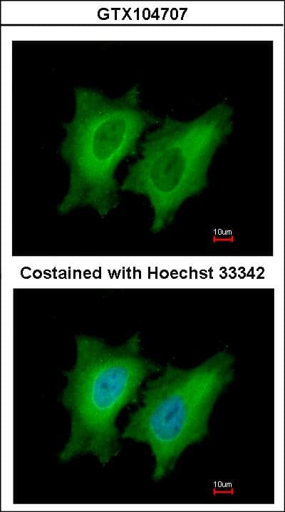 PathPlus™ STMN1 / Stathmin / LAG Antibody