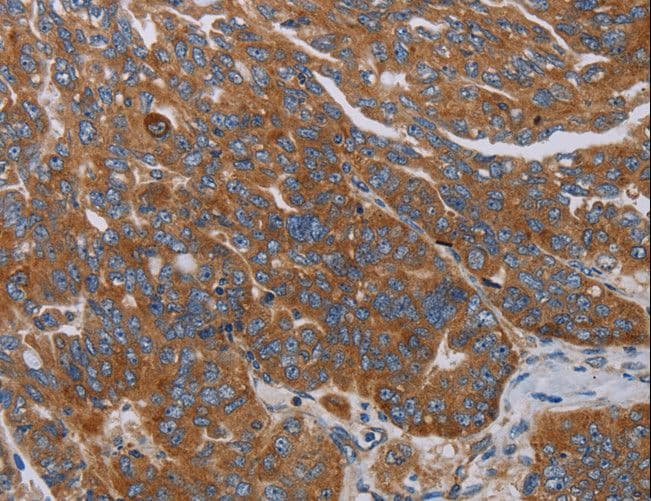 PARP10 Antibody