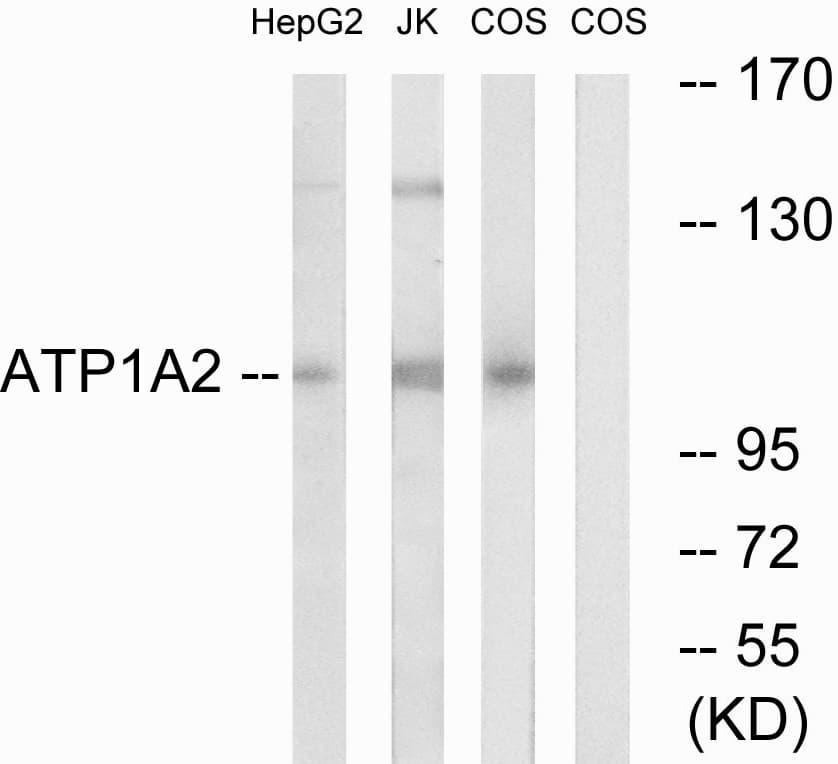 ATP1A2 Antibody (aa971-1020)