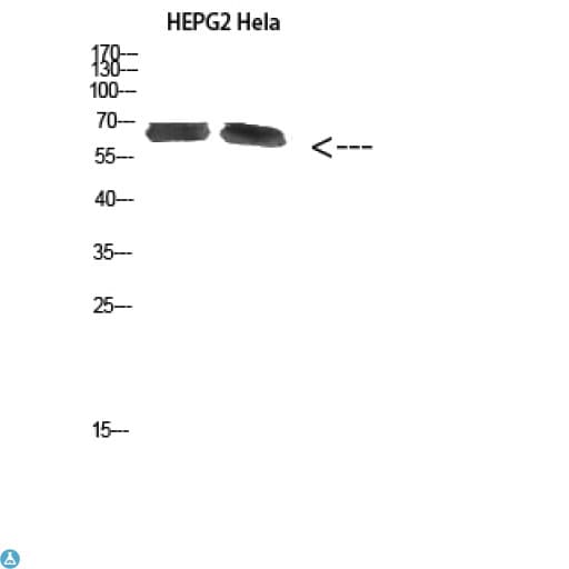 Polyclonal Rabbit anti-Human NOL5A / NOP56 Antibody (WB)