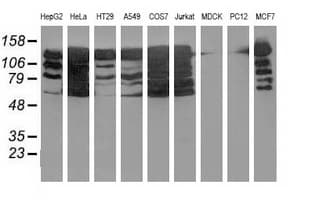 BUB1B / BubR1 Antibody (clone OTI6E3)