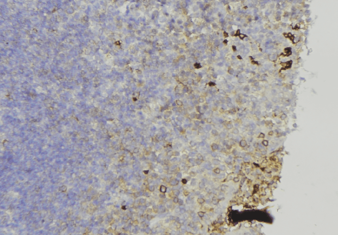 Polyclonal Rabbit anti-Human COL17A1 / Collagen XVII Antibody (IHC, IF, WB)