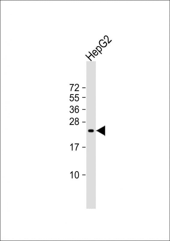 Polyclonal Rabbit anti-Human SRY Antibody (aa52-82, WB)