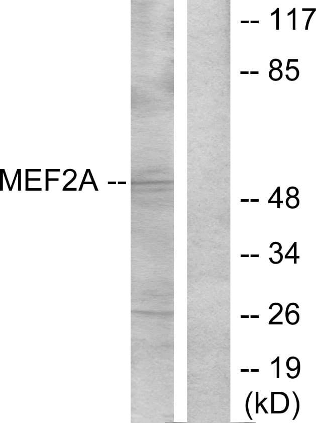 Polyclonal Rabbit anti-Human MEF2A / MEF2 Antibody (aa279-328, IHC, WB)