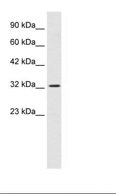 SMARCA2 / BRM Antibody (aa58-107)