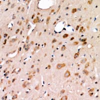 Monoclonal Mouse anti-Human ERN1 / IRE1 Antibody (IHC, WB)