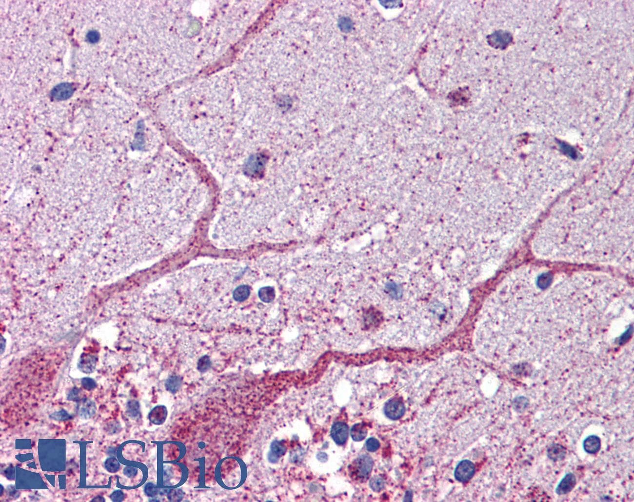 GCLC Antibody (aa74-123)