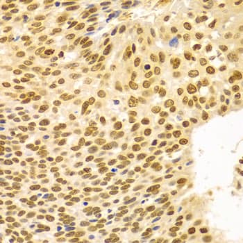 Polyclonal Rabbit anti-Human DKC1 / Dyskerin Antibody (IHC, IF, WB)