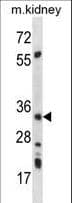 PRKAB2 / AMPK Beta 2 Antibody (aa3-33)