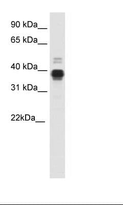 Polyclonal Rabbit anti-Mouse HOXA11 Antibody (aa210-259, IHC, WB)