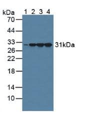 CALB2 / Calretinin Antibody (aa28-248)